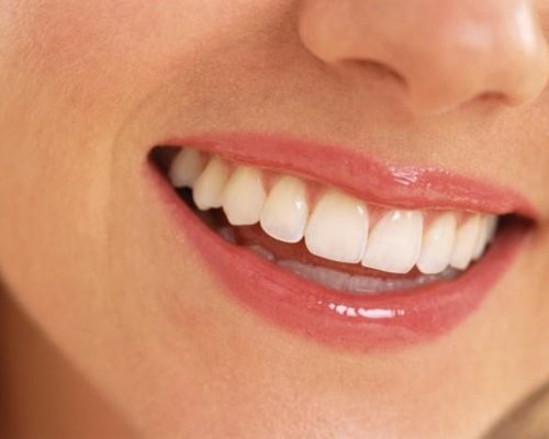 denti 2